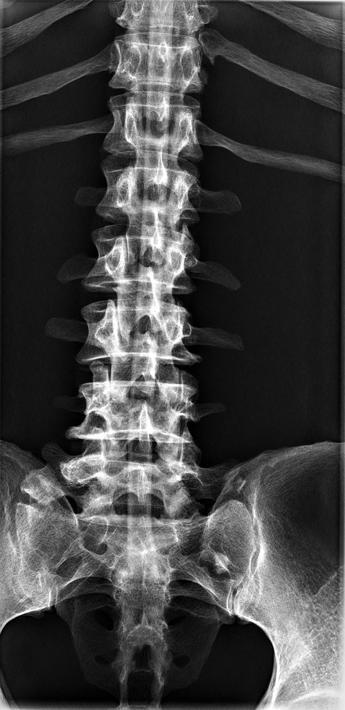 Fantôme de test pour radiographie - corps humain